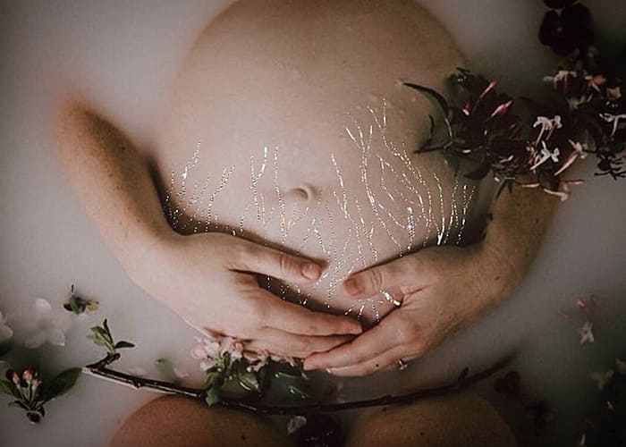Glitter Stretch Marks
